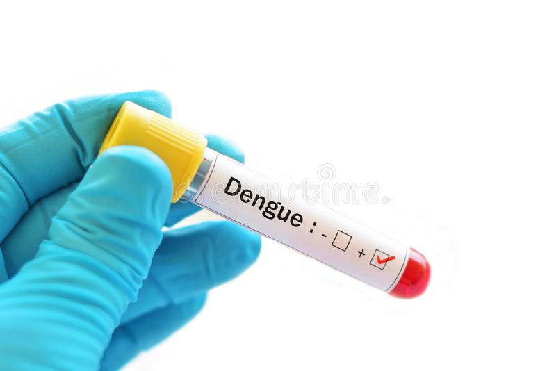 Dengue Ns1 Antigen Detection - Elisa