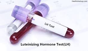 Lh-luteinizing Hormone